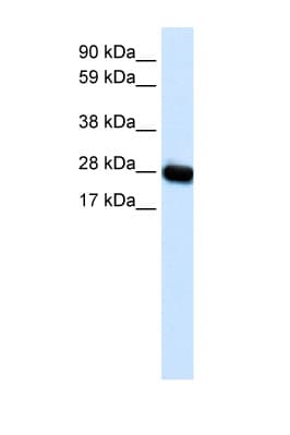 CAV3 / Caveolin 3 Antibody (N-Terminus)