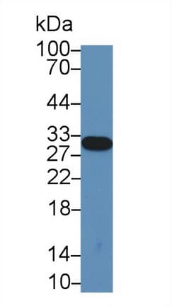 Complement C1QA Antibody (aa23-245, APC)