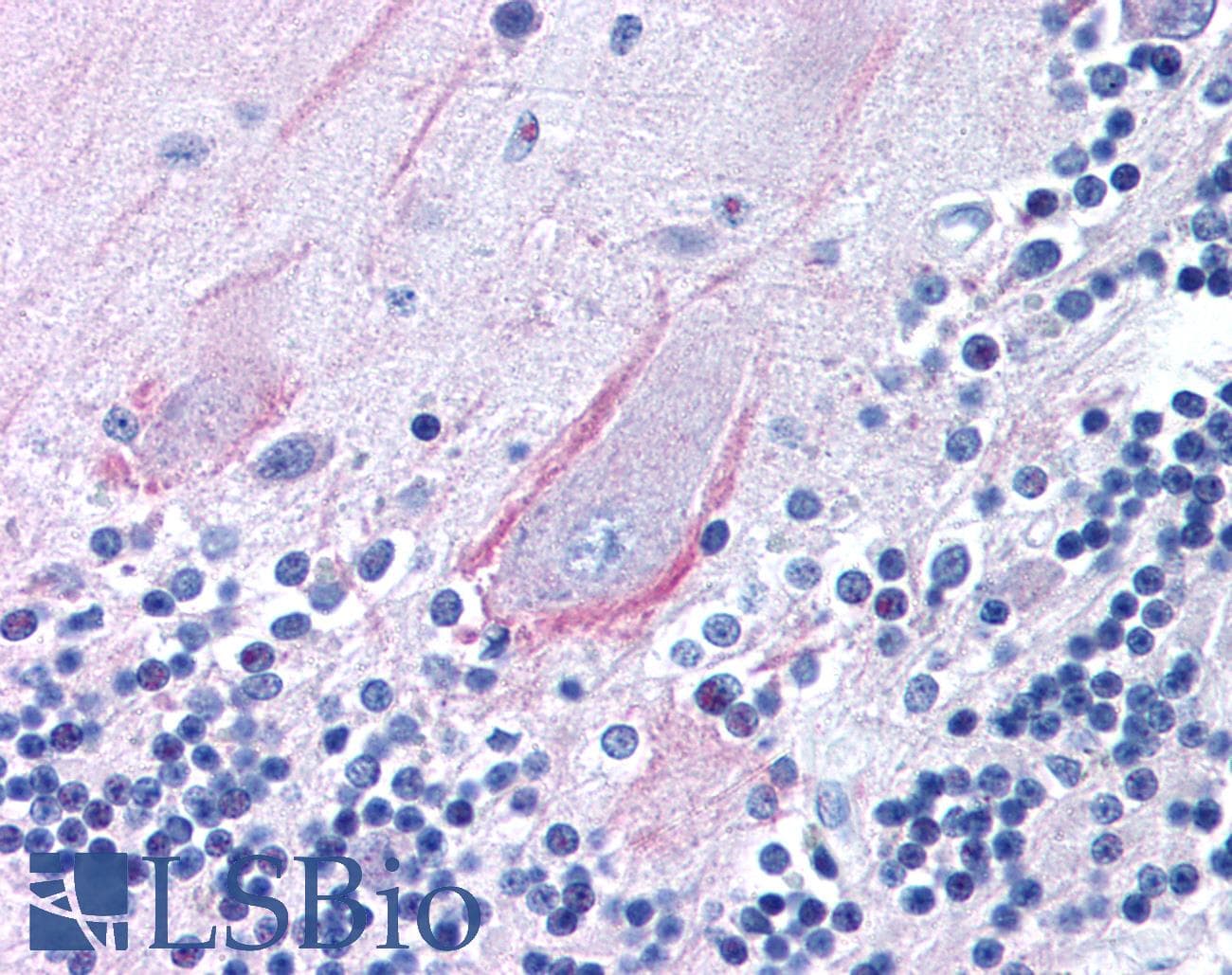 TRPA1 Antibody (N-Terminus, Biotin)