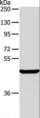 Polyclonal Rabbit anti-Human ALKBH1 / ALKB Antibody (WB)