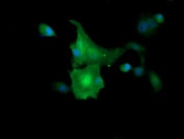 MAP2K1 / MKK1 / MEK1 Antibody (clone OTI6C6)