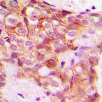 COL5A1 / Collagen V Alpha 1 Antibody (Internal)