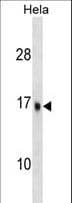 UBE2D3 / UBCH5C Antibody (aa109-136)