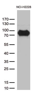CSF2RA / CD116 Antibody (aa23-320, clone OTI2E12)