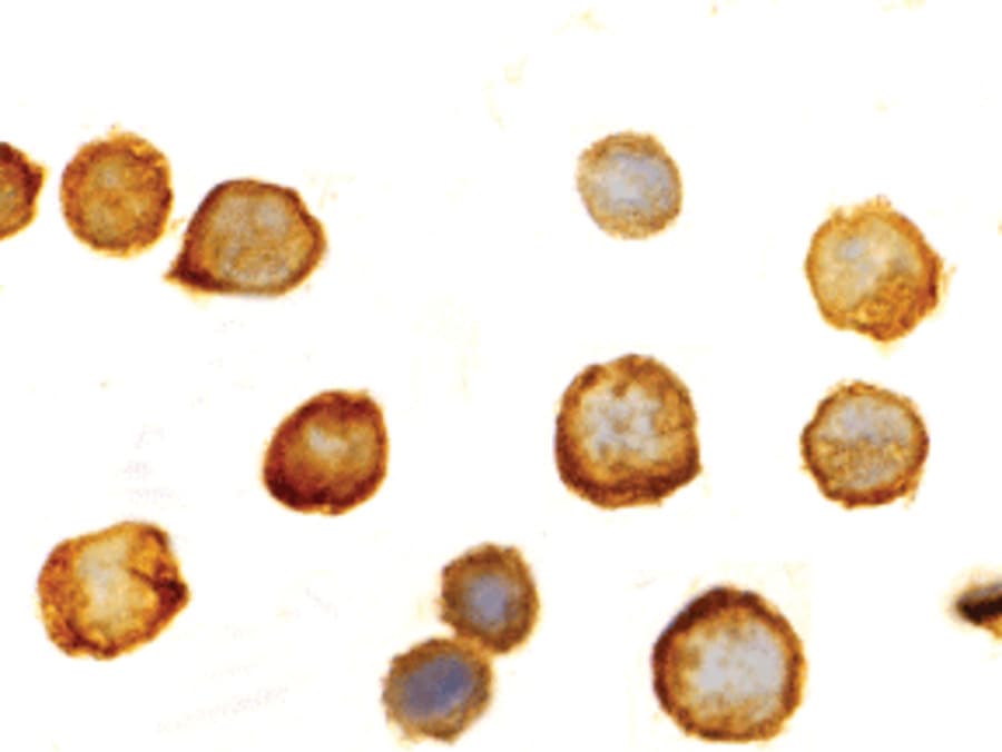 IHC-plus™ Polyclonal Rabbit anti-Human TLR5 Antibody (IHC, IF, WB)