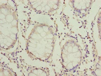 Polyclonal Rabbit anti-Human HOOK1 Antibody (IHC, WB)