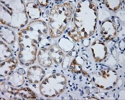 LIPG / Endothelial Lipase Antibody (clone OTI2A5)