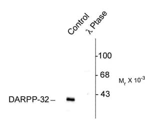 PPP1R1B / DARPP-32 Antibody (phospho-Thr75)
