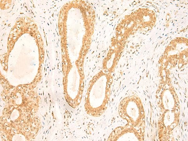 ST8SIA4 Antibody