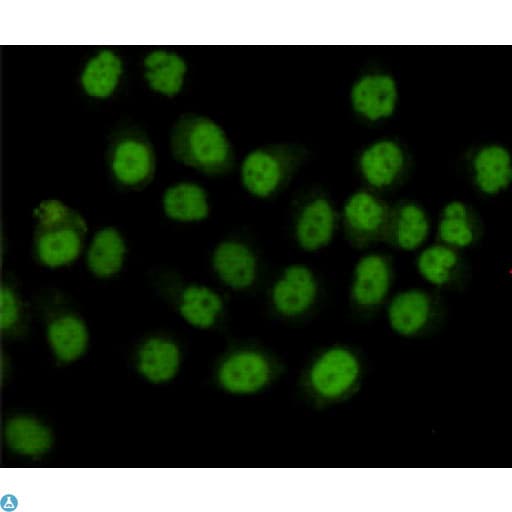 SMC1A / SMC1 Antibody