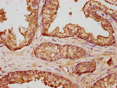ANXA5 / Annexin V Antibody (aa2-320)