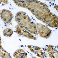 Polyclonal Rabbit anti-Human CEP57L1 Antibody (IHC, WB)