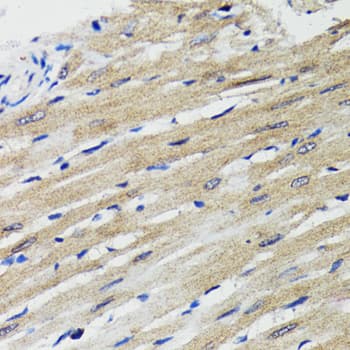 Polyclonal Rabbit anti-Human BAP29 / BCAP29 Antibody (IHC, WB)