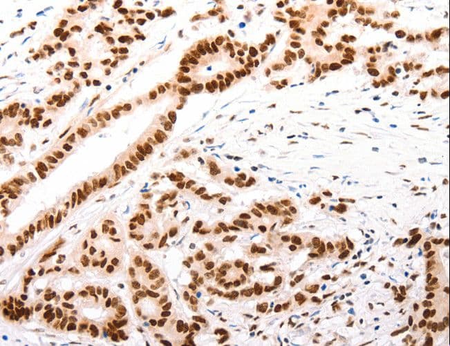 CASP9 / Caspase 9 Antibody