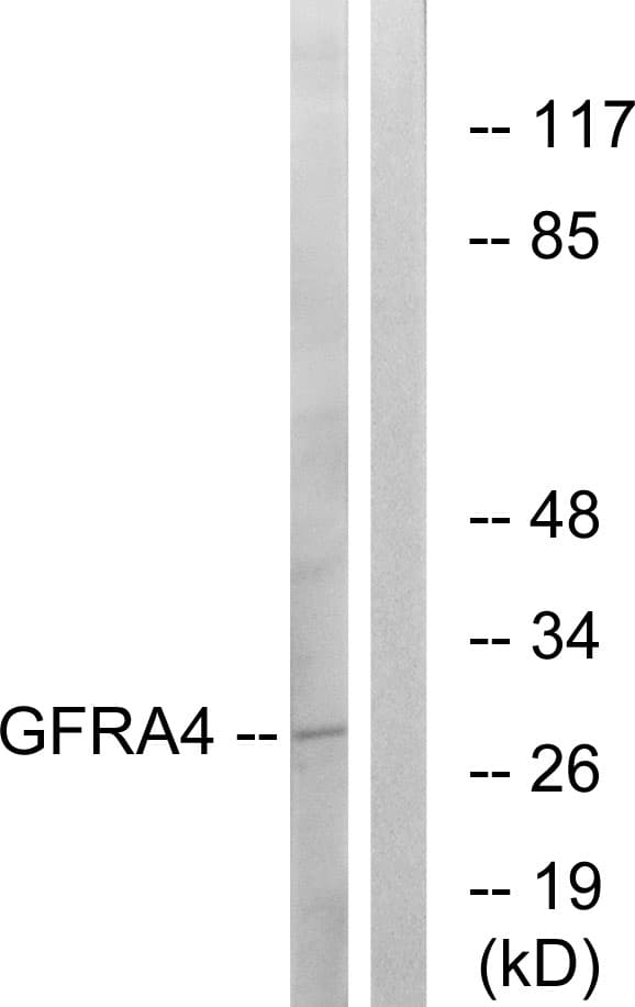 GFRA4 Antibody (aa141-190)