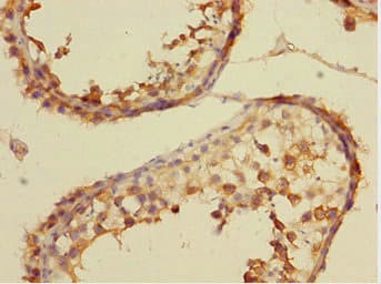 CSRNP2 / FAM130A1 Antibody