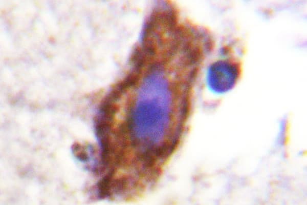CSF1R / CD115 / FMS Antibody (Glu557)