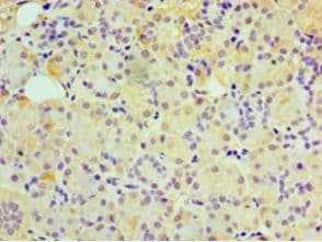 Polyclonal Rabbit anti-Human GUCA2B / Uroguanylin Antibody (aa37-112, IHC)