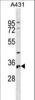 RPS6 / Ribosomal Protein S6 Antibody (aa1-30)