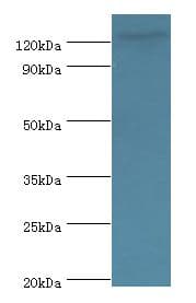 NLRP2 / NALP2 Antibody (aa1-220)