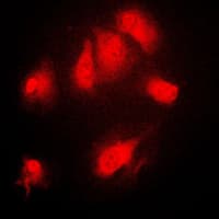 NFKBIA / IKB Alpha / IKBA Antibody (phospho-Ser32/Ser36)
