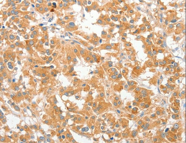 COL4A3BP / CERT Antibody
