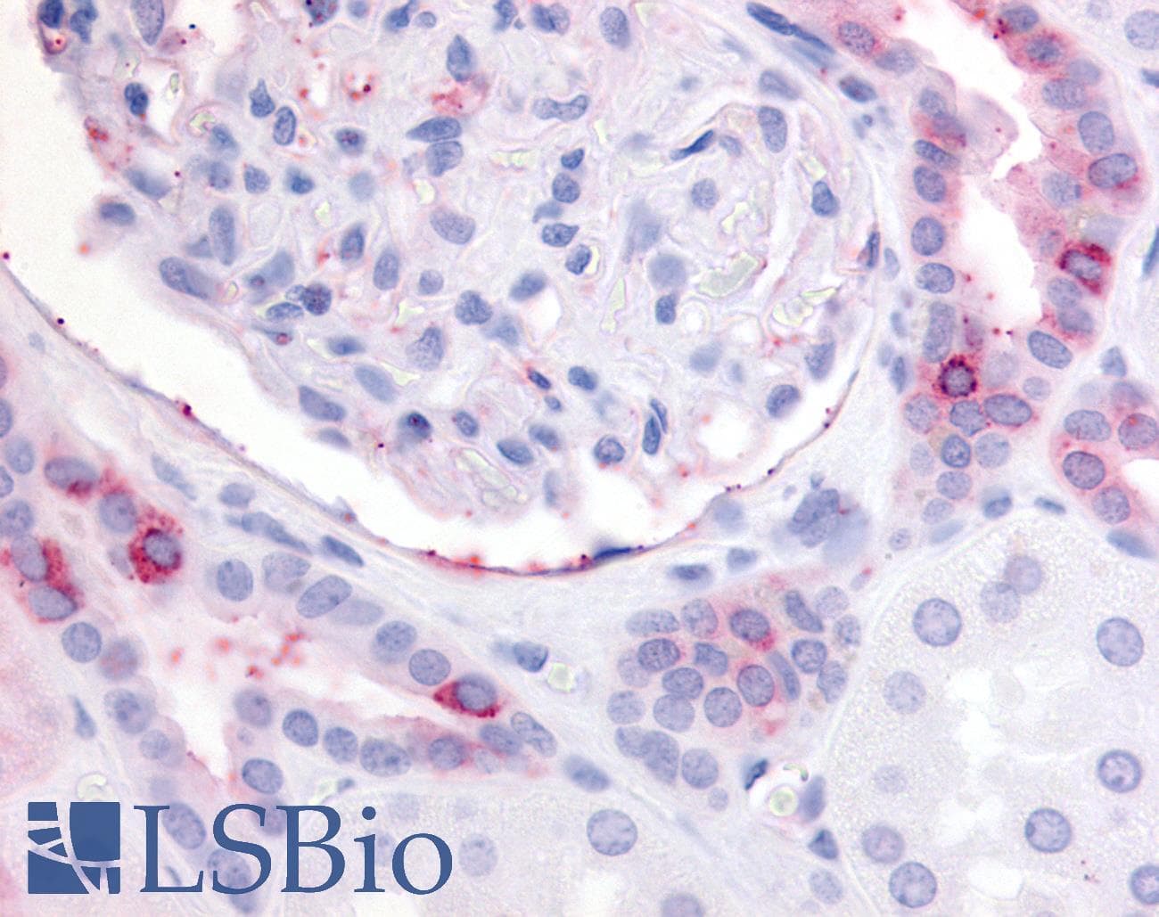 IHC-plus™ Polyclonal Rabbit anti-Human PTGER2 / EP2 Antibody (N-Terminus, IHC)