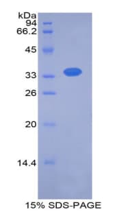 Human SERPINA7 / TBG Protein (Recombinant His)