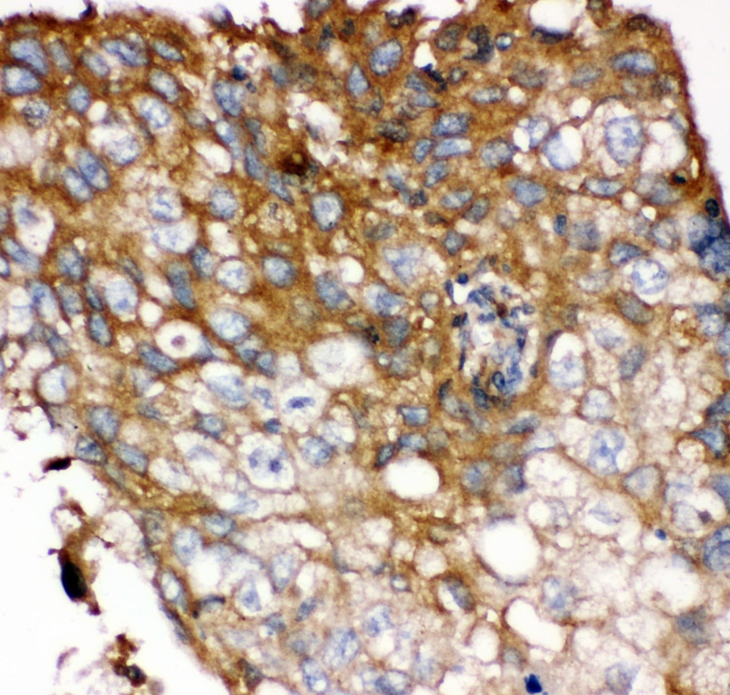 FGFR4 Antibody (aa22-206)