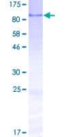 Human BMPER Protein (Recombinant GST)