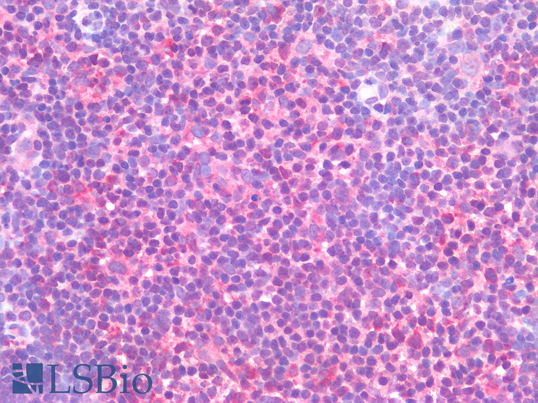 IHC-plus™ RORC / ROR Gamma Antibody (Ligand-binding Domain)