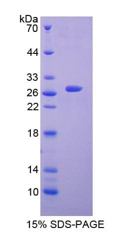 Human CHAT Protein (Recombinant His-T7)
