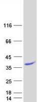 Human BLOC1S3 Protein (Recombinant Myc-DDK (Flag))
