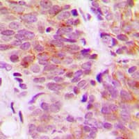 Polyclonal Rabbit anti-Human RPS6KB1 / P70S6K / S6K Antibody (C-Terminus, IHC, WB)