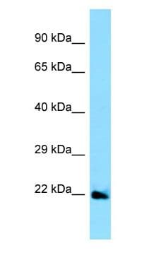 EFNA5 / Ephrin A5 Antibody (aa84-133)