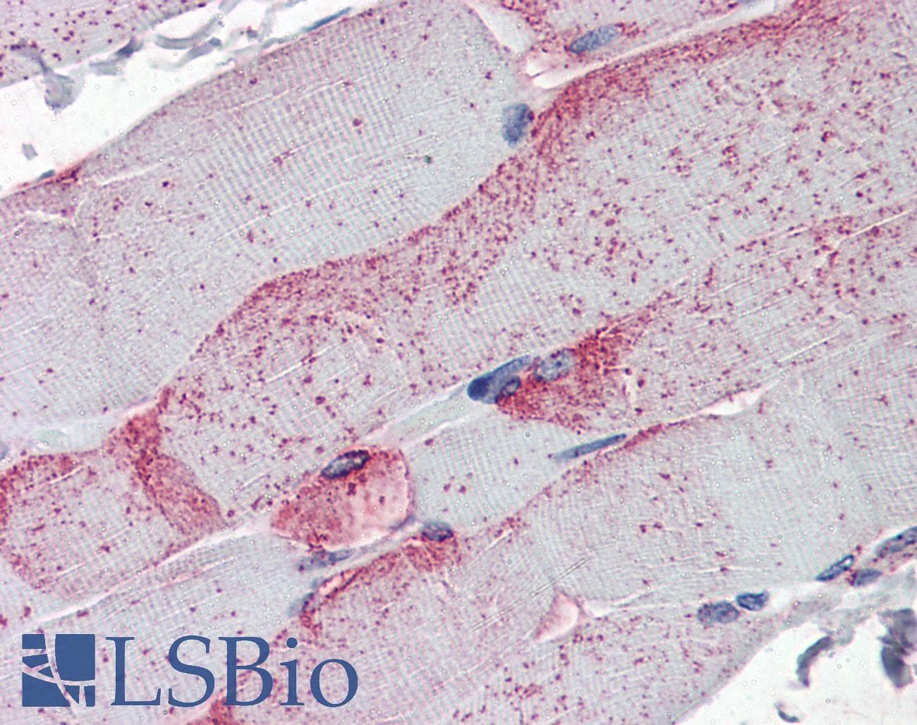 IHC-plus™ CDH11 / Cadherin 11 Antibody (Intracellular, clone 5B2H5)