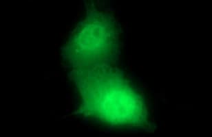 CHAC1 / MGC4504 Antibody (clone OTI1G7)