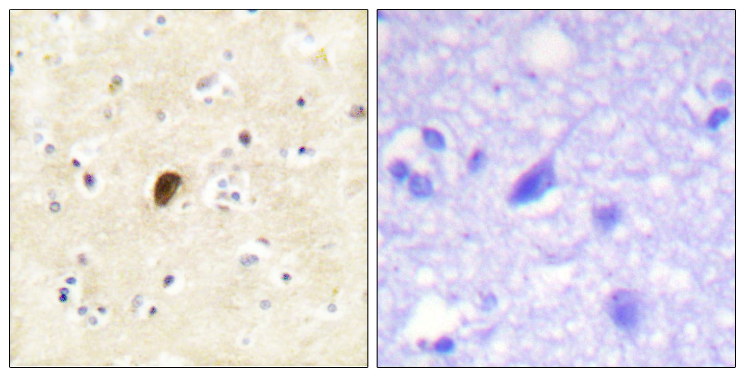 GRIA4 / GLUR4 Antibody (phospho-Ser862)