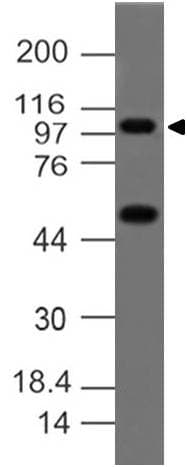 TNFAIP3 / A20 Antibody