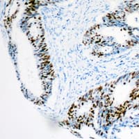 HMGN2 Antibody (N-Terminus)