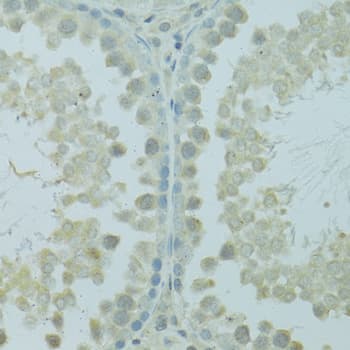 HUS1B Antibody