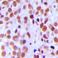 Polyclonal Rabbit anti-Human XRCC5 / Ku80 Antibody (C-Terminus, IHC, IF, WB)