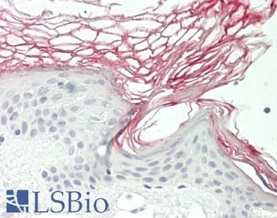 IHC-plus™ Polyclonal Rabbit anti-Human KLK7 / Kallikrein 7 Antibody (aa1-253, IHC, WB)