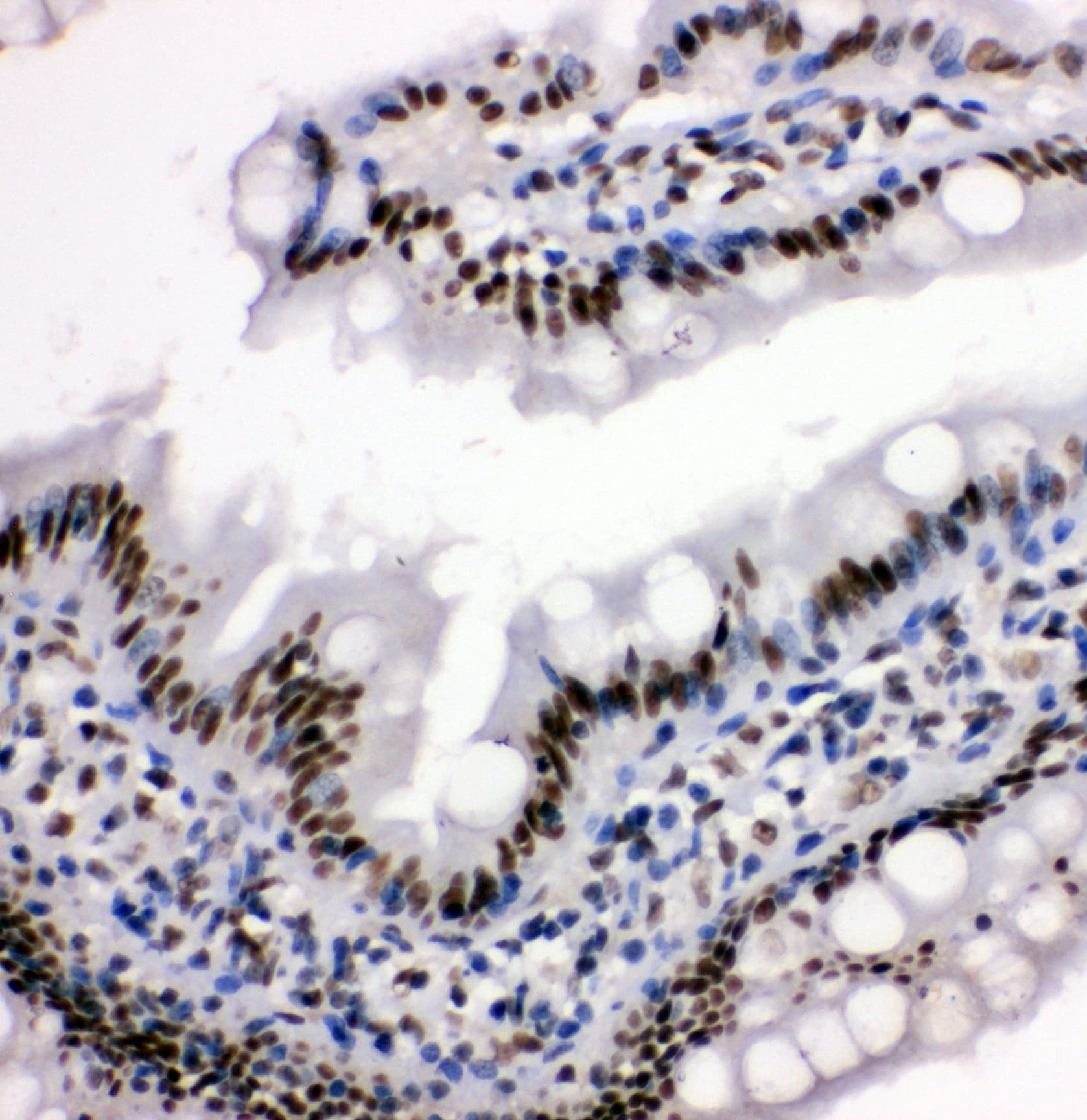 Polyclonal Rabbit anti-Human HDAC3 Antibody (aa1-18, IHC, WB)
