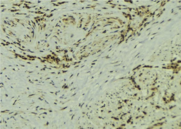SS18L1 / CREST Antibody