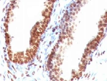 DNA ds Antibody (clone DRNC1-1)