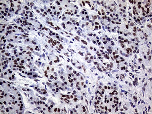 ERCC3 / XPB Antibody (aa191-436, clone OTI6H8)