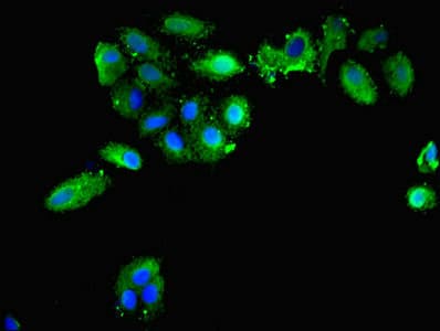 PRDX1 / Peroxiredoxin 1 Antibody
