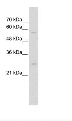 SOCS1 Antibody (aa21-70)