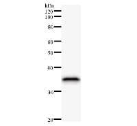 MTA3 Antibody (clone 428C2a)